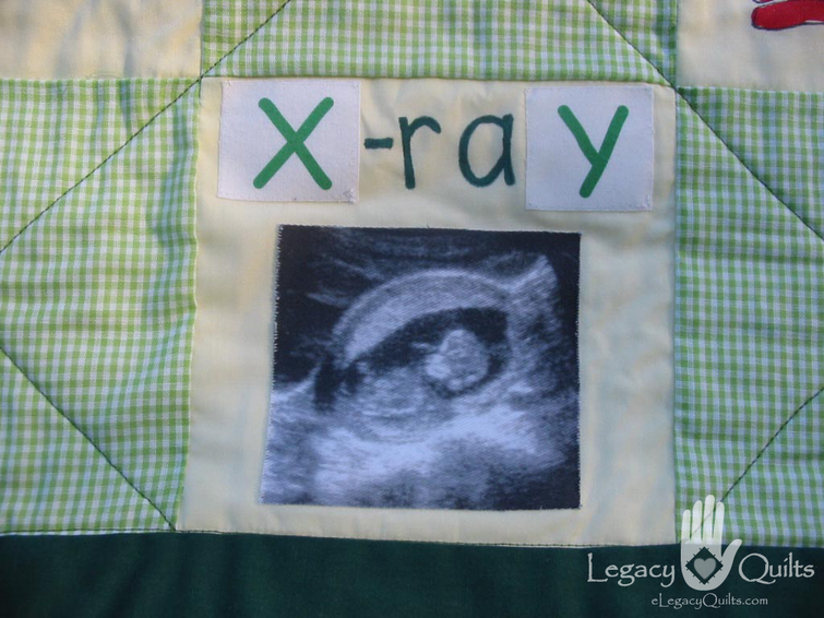 Sarah's ABC Quilt -XY Block Detail